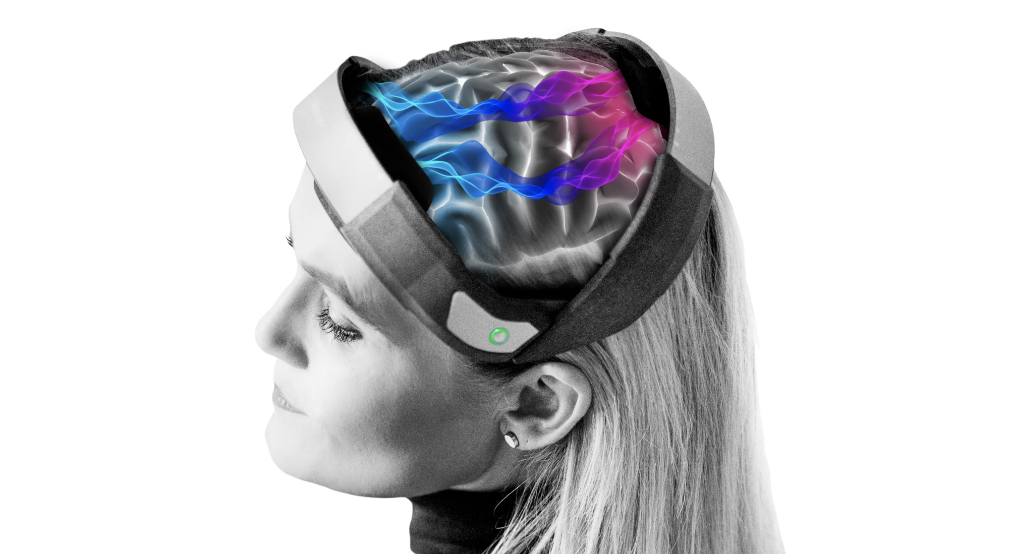 tDCS Estimulación Transcraneal por corriente directa Madrid