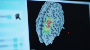 La Neuromodulación No Invasiva: Una Herramienta Prometedora para el Tratamiento de Enfermedades Mentales